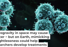 Cancer cells are more hardy in the low-gravity conditions of space. koto_feja/iStock via Getty Images Plus